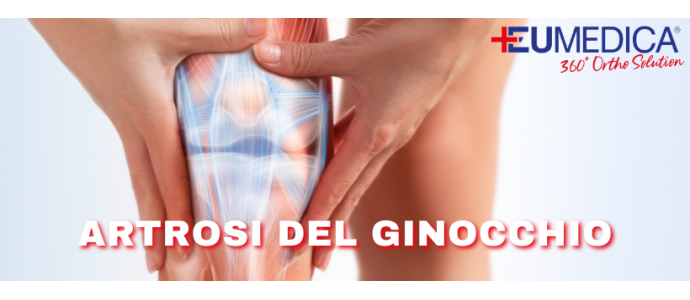 Il ginocchio e l'artrosi